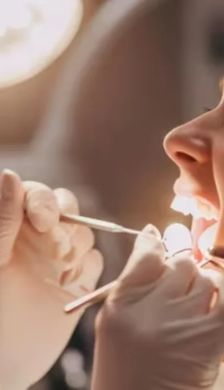 Mantener una correcta higiene bucal y visitar con regularidad al odontólogo es importante no sólo para prevenir o tratar a tiempo las caries.