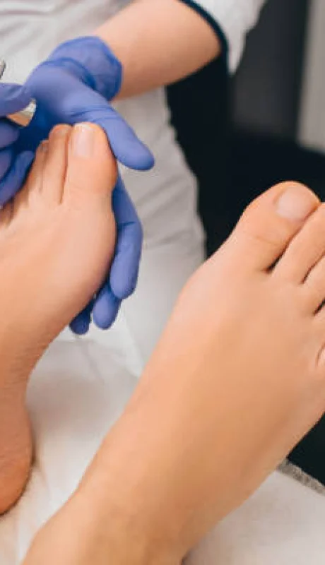 Cuidado de pies
