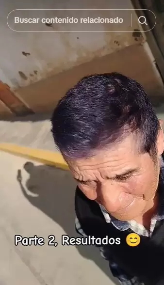 El resultado de teñirse con el color equivocado.