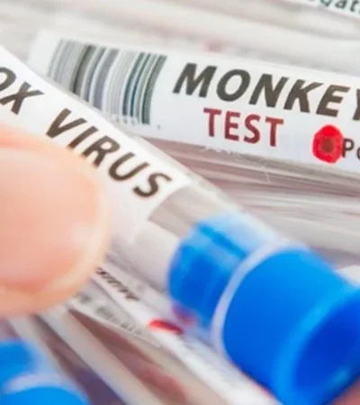 La vacuna antiviruela símica tuvo su primera aprobación.