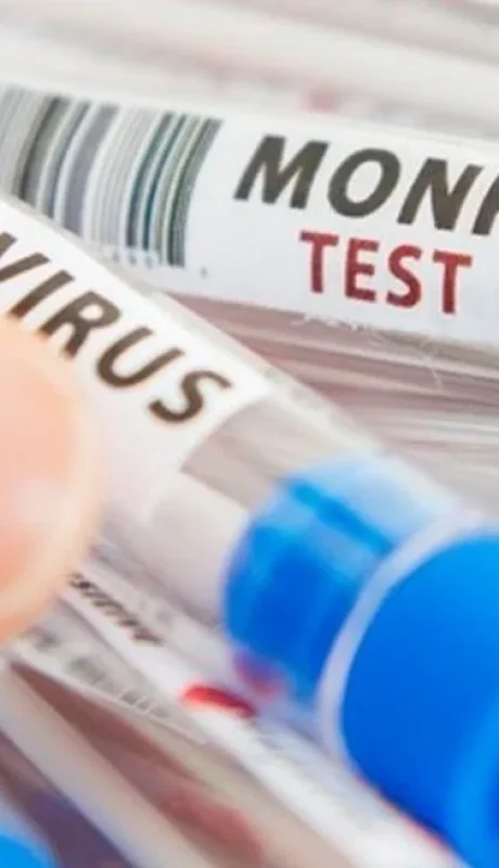 La vacuna antiviruela símica tuvo su primera aprobación.