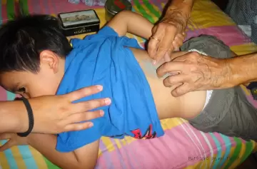 Cuáles son las mejores técnicas para curar el empacho