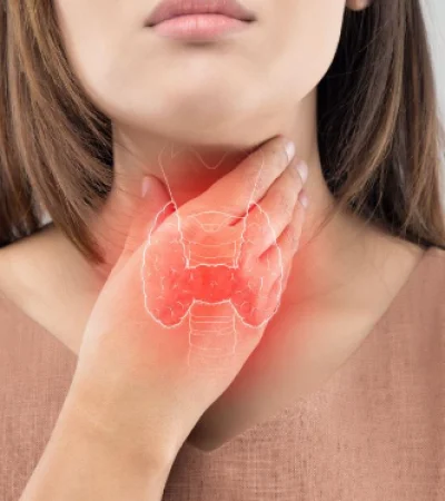 El cáncer de tiroides se puede identificar en el momento que aparecen masas en la zona frontal del cuello.