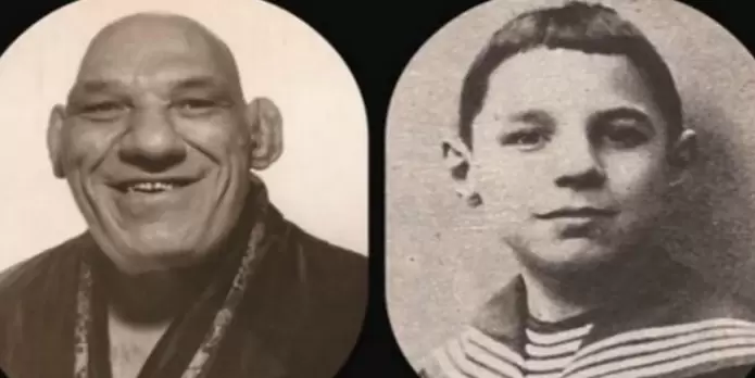 Uno de los problemas de la afección es el diagnóstico tardío, que se puede demorar hasta 10 años.