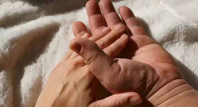 La acromegalia es una enfermedad rara endocrina, caracterizada por un exceso de secreción persistente de la hormona del crecimiento (GH).