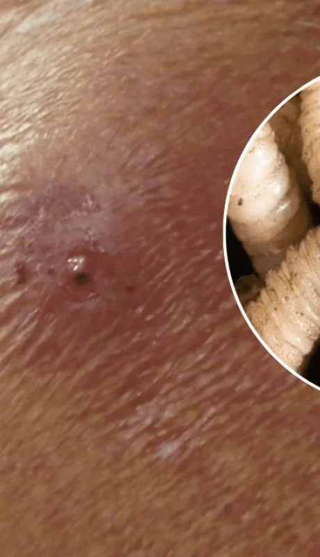 El gusano barrenador no solo ataca el ganado, sino que cualquier animal de sangre caliente puede ser afectado; inclusive humanos.