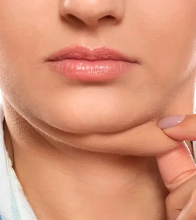 Adiós a la papada: la vitamina que promete eliminarla en pocos días