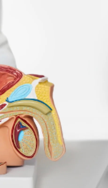 Hasta el momento se desconoce con exactitud por qué da cáncer de próstata.