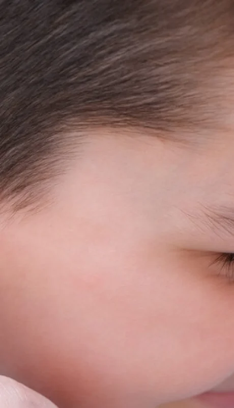 La otitis es una inflamación del oído que puede afectar tanto a niños como a adultos.