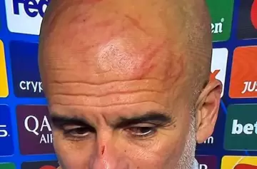 ¿Qué le pasó a Guardiola? Entre arañazos y crisis futbolística