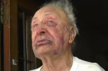 Jubilado de 88 años fue brutalmente golpeado en un asalto: "Tenía miedo de que me mataran"