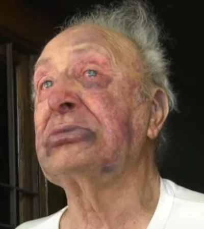 Jubilado brutalmente golpeado para robarle