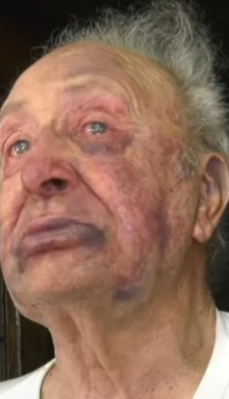 Jubilado brutalmente golpeado para robarle
