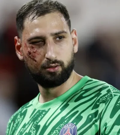 Así quedó el rostro del italiano