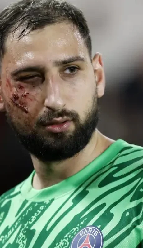 Así quedó el rostro del italiano