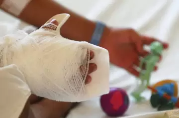 Fin de Año sin riesgos: los peligros de la pirotecnia y cómo evitarlos