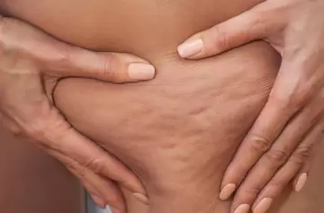 La dieta recomendada para evitar retener líquidos