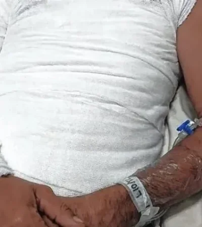 Su hermano le prendió fuego tras discutir por un sachet de mayonesa