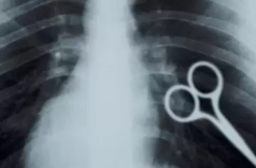 Impactante: preso se tragó una tijera en un penal sanjuanino