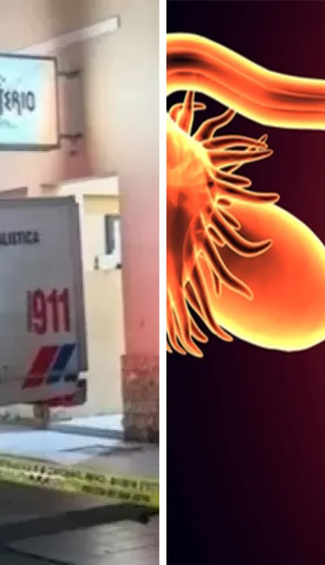 El shock neurogénico fue derivado de una enfermedad ginecológica preexistente.