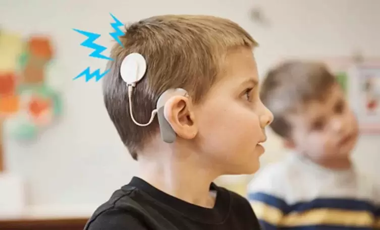 Se trata de una opción de tratamiento importante para aquellas personas que tienen dificultades auditivas graves o que no pueden utilizar audífonos.