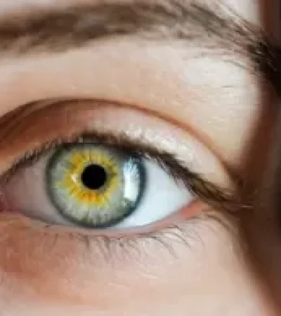 Luteína: la tenemos en nuestro cuerpo, y previene el glaucoma.