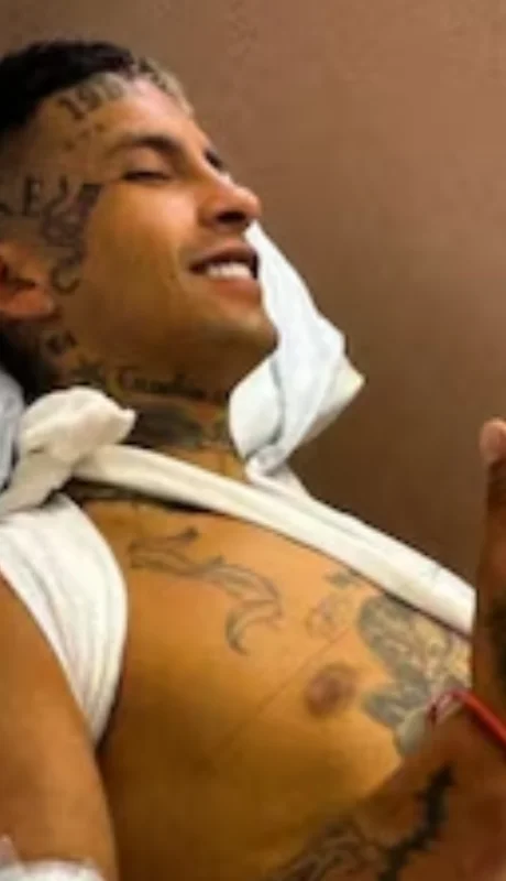 Su cuadro se complicó y deberá pasar por el quirófano.