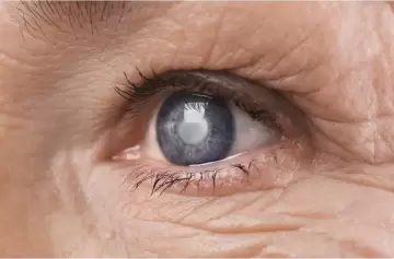 Llega el Día Mundial del Glaucoma, el enemigo silencioso