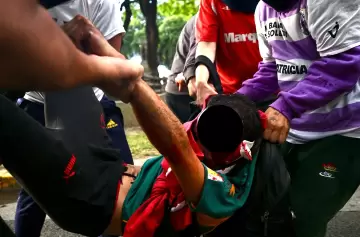 El fotógrafo Pablo Grillo fue operado, pero su estado sigue siendo crítico