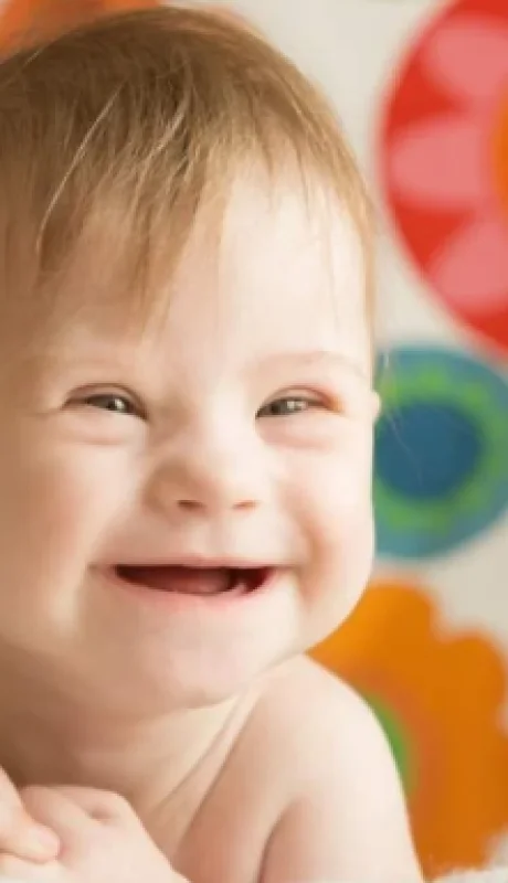 Aunque las personas con síndrome de Down pueden tener complicaciones, la salud de muchos de estos niños no tiene por qué ser distinta a la del resto.