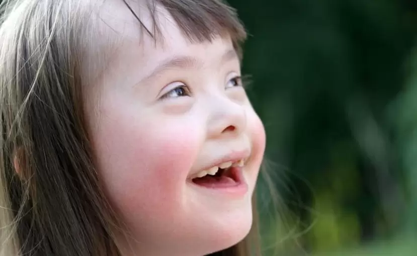 Cada persona que nace con síndrome de Down es diferente. Algunos tienen problemas de salud.