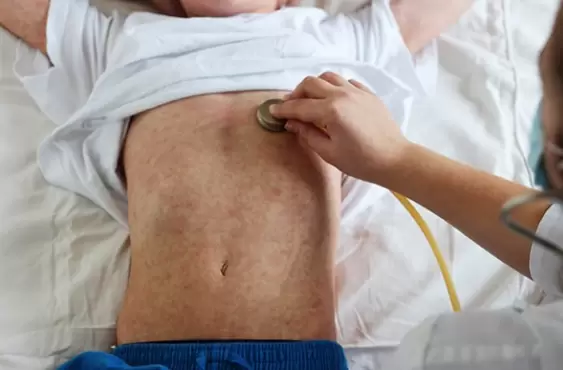 A partir de la aparición de brotes en Argentina, Estados Unidos, México, Canadá, Europa y Asia, se encendieron las alarmas por posibles contagios.