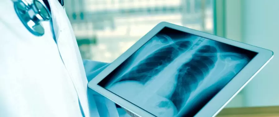 El aumento en la presión arterial en los pulmones puede llevar a complicaciones severas si no se maneja adecuadamente.