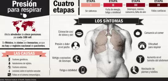 En los últimos años se ha detectado que esta anomalía cardíaca se presenta en uno de cada 200 pacientes con VIH.