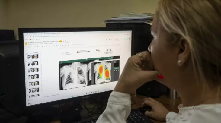 La tuberculosis es una de las enfermedades infecciosas más mortales en las Américas, donde cada día se diagnostican 900 casos y 100 personas mueren.