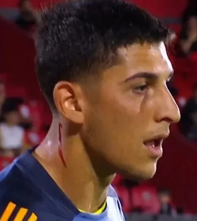 Leandro Brey fue cortado con un elemento tirado desde la tribuna en la entrada en calor/