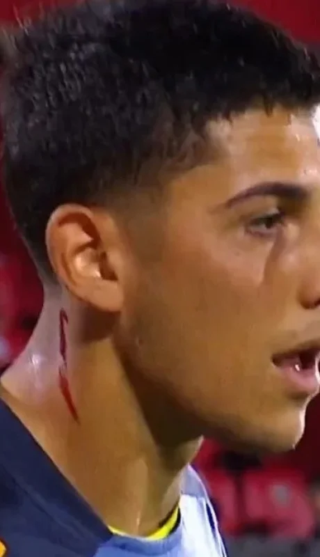 Leandro Brey fue cortado con un elemento tirado desde la tribuna en la entrada en calor/