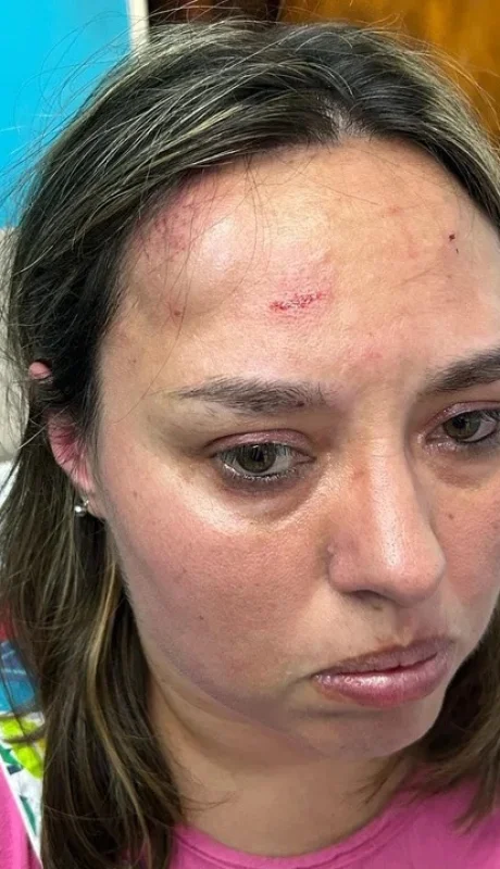 Tras el ataque, la regente, la subregente y la secretaria terminaron con lesiones graves.