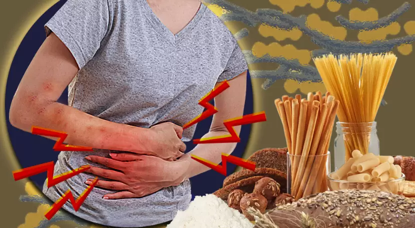 La celiaquía es una patología crónica y autoinmune y el origen es la intolerancia permanente al gluten