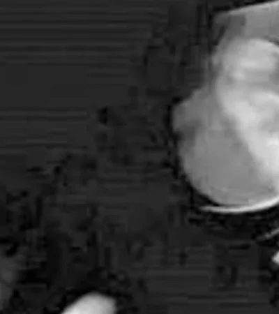 Una conocida organización de investigación y exposición de abusos eclesiásticos apuntó contra el desempeño del papa en hechos ligados a su pasado.