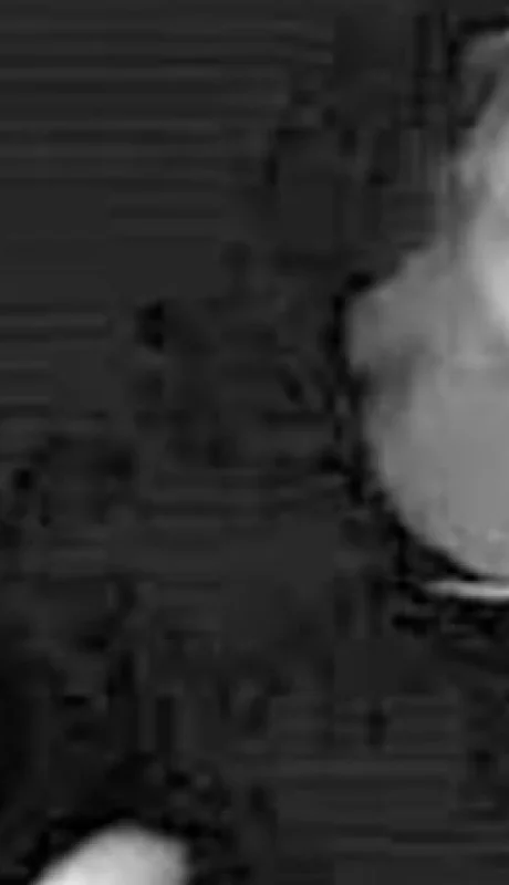 Una conocida organización de investigación y exposición de abusos eclesiásticos apuntó contra el desempeño del papa en hechos ligados a su pasado.