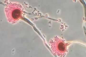 Hongo mortal se expande por el mundo y el cambio climático podría desatar una pandemia silenciosa