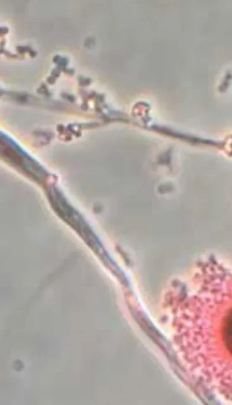 El Aspergillus.