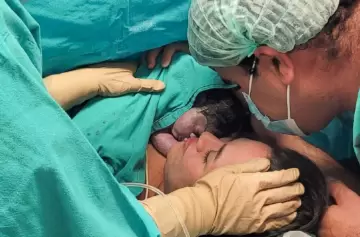 Nació la primera bebé operada dentro del útero de su madre en el Garrahan