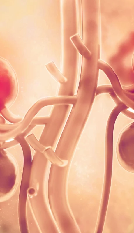 Cáncer renal: síntomas, factores de riesgo y cómo prevenir la enfermedad.