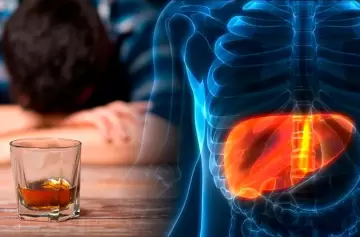 Hígado graso: las propiedades de una verdura que revierte esta condición