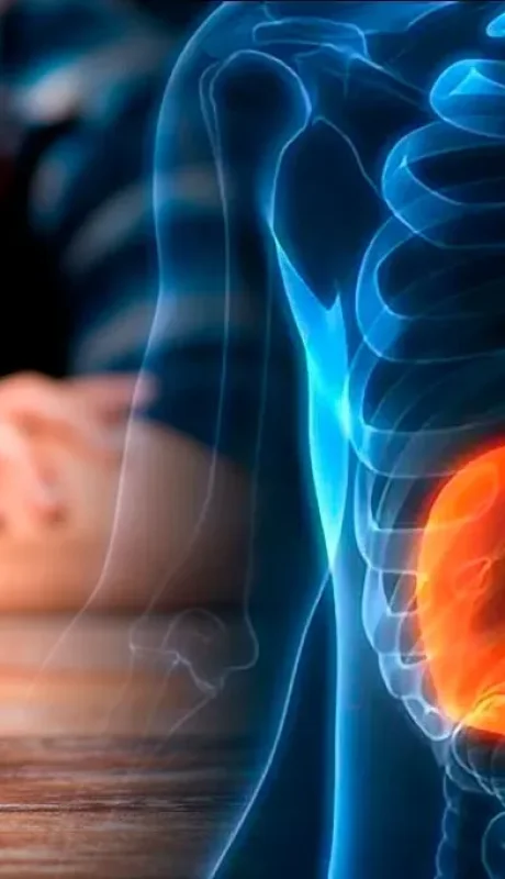 Es silencioso. Pero el hígado graso nos da señales.