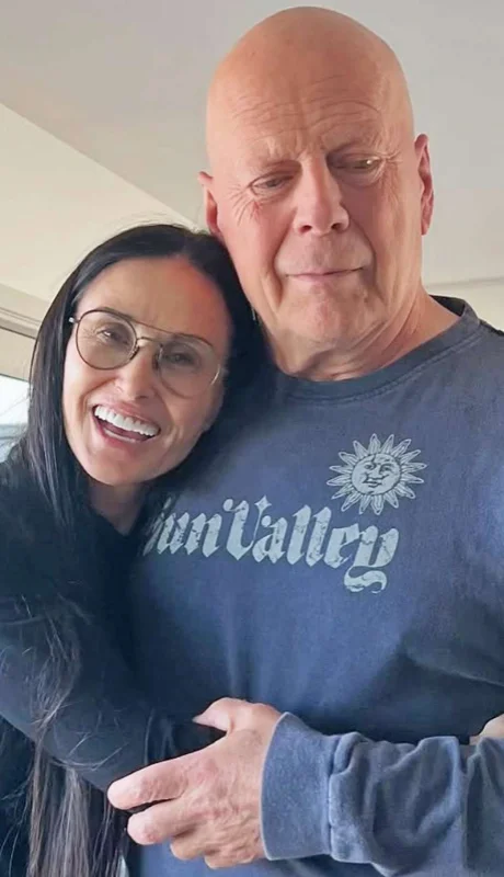 Bruce Willis fue diagnosticado con afasia en 2022, lo que lo llevó a retirarse de la actuación.