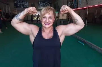 El nuevo parte médico de "Locomotora" Oliveras informa un daño irreversible