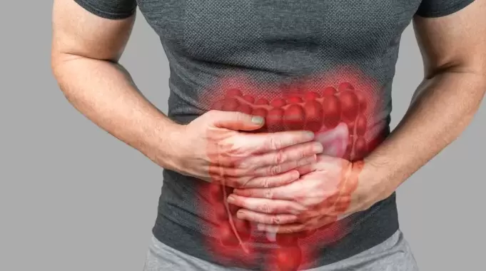 El cáncer de colon es un tumor más frecuente a partir de los 50 pero cada vez aparece más en jóvenes.